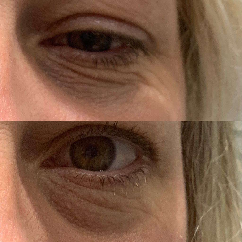 Review of the Geneo+ Superfacial at Nu-Beau for Instantly younger and plumper looking shik by lifestyle blogger Maxine Brady GIFTED ITEM