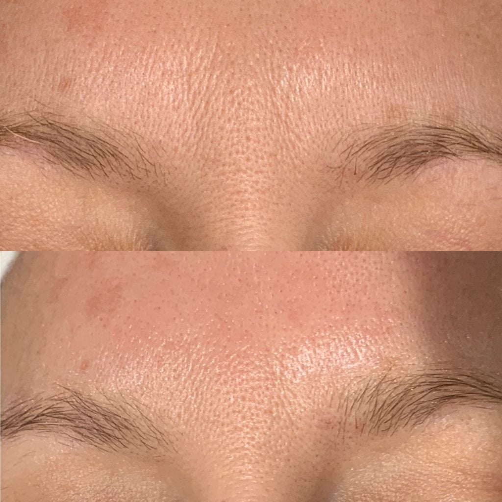 Review of the Geneo+ Superfacial at Nu-Beau for Instantly younger and plumper looking shik by lifestyle blogger Maxine Brady GIFTED ITEM